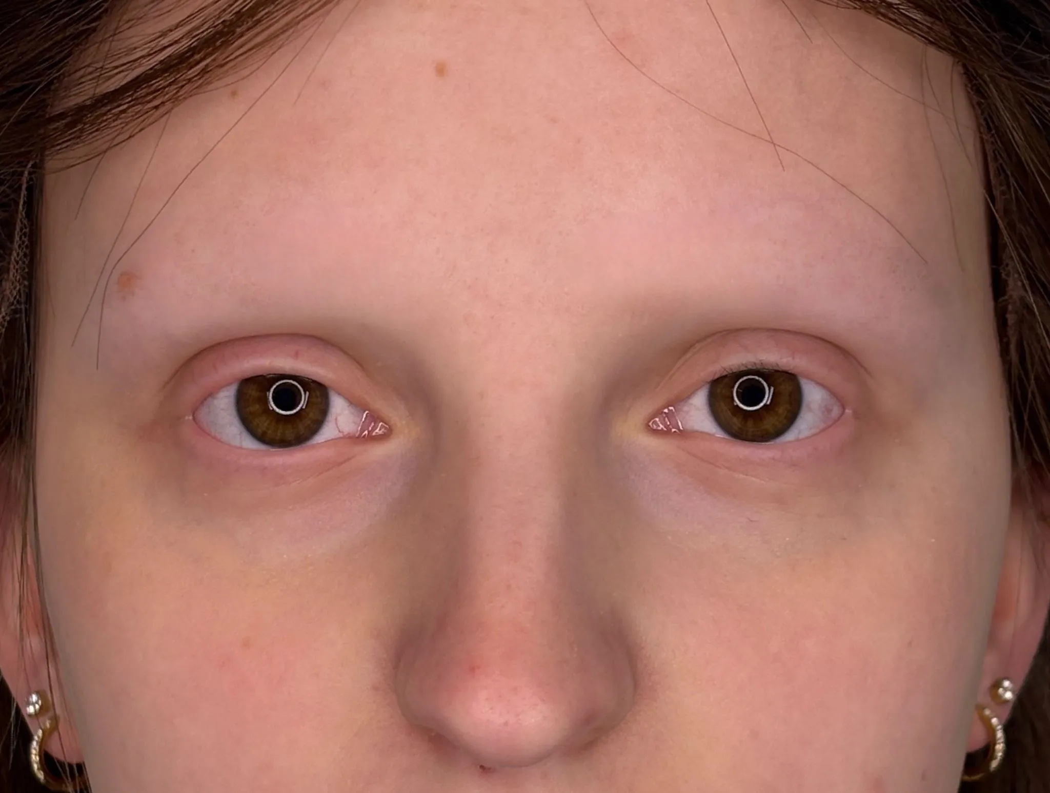 Brows before treatment