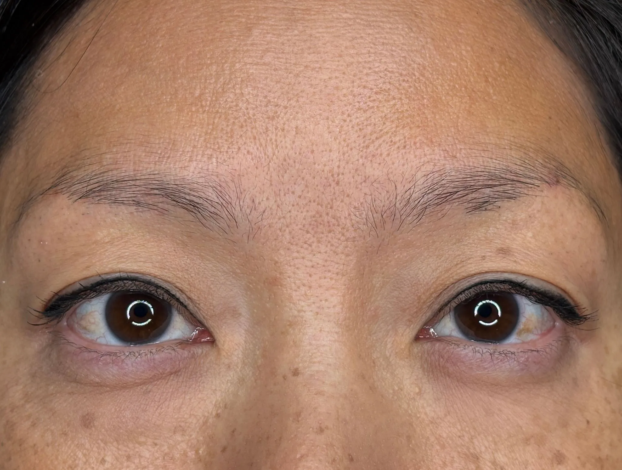 Brows before treatment