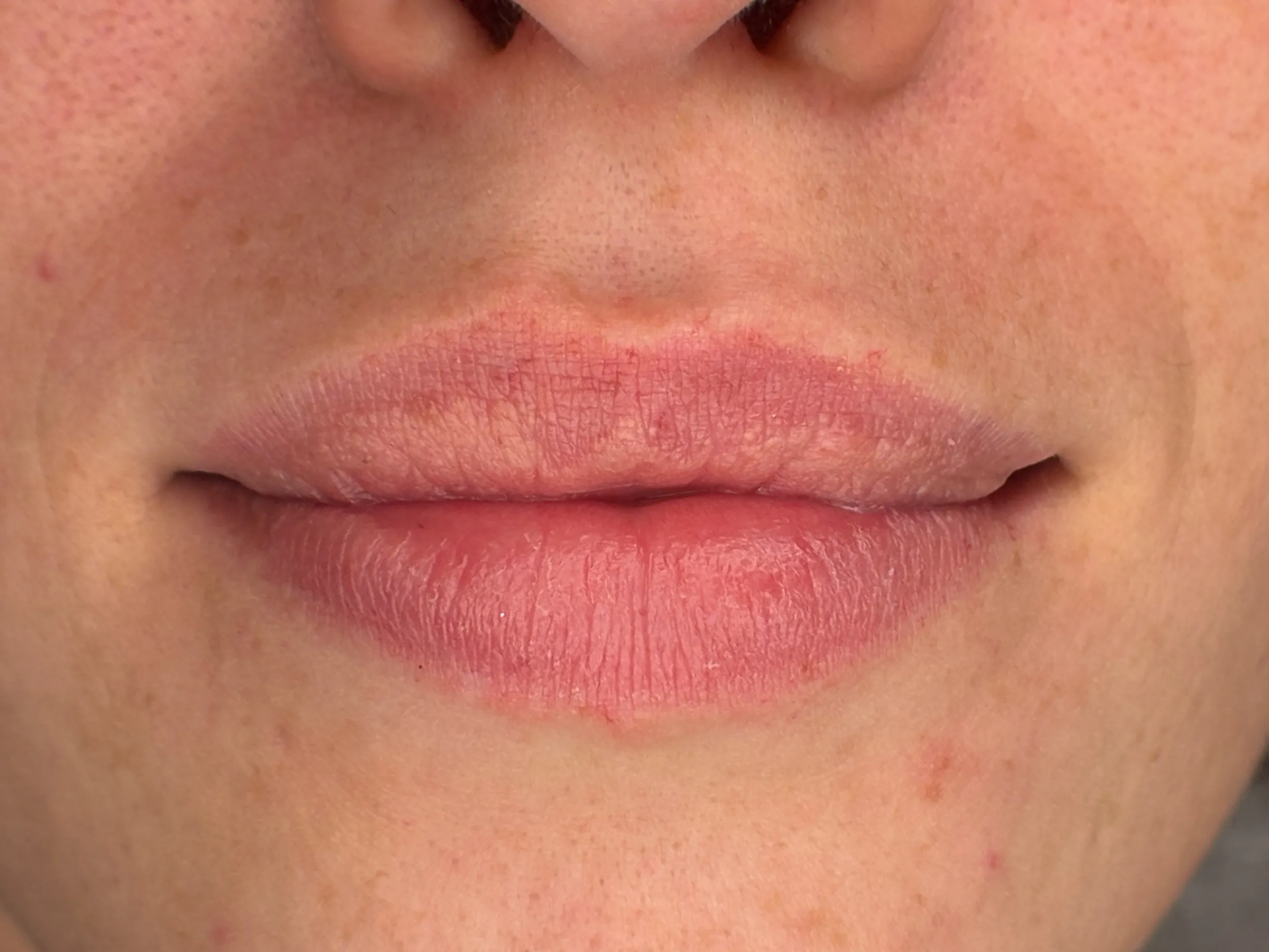 Lips before Lip Blush treatment