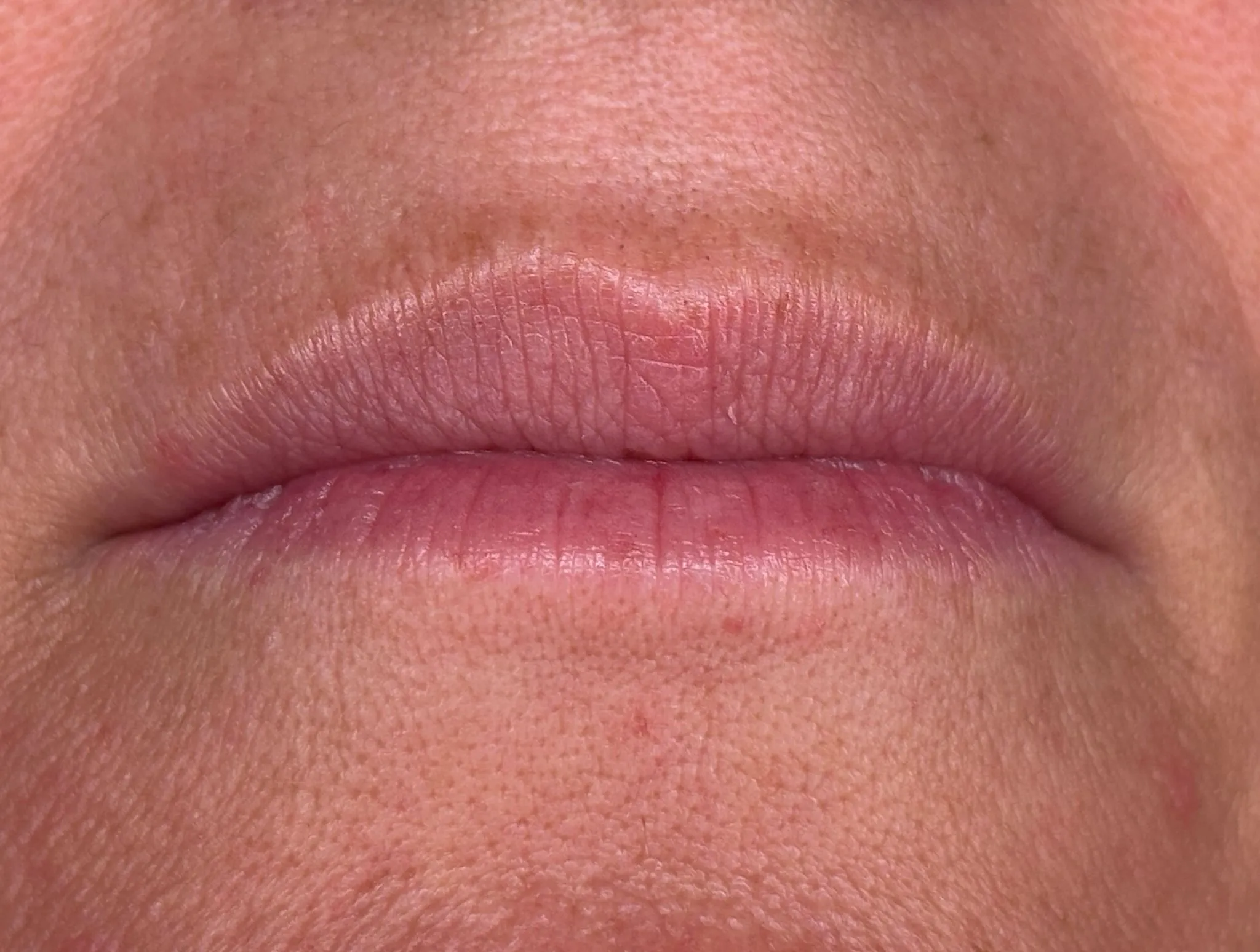 Lips before Lip Blush treatment